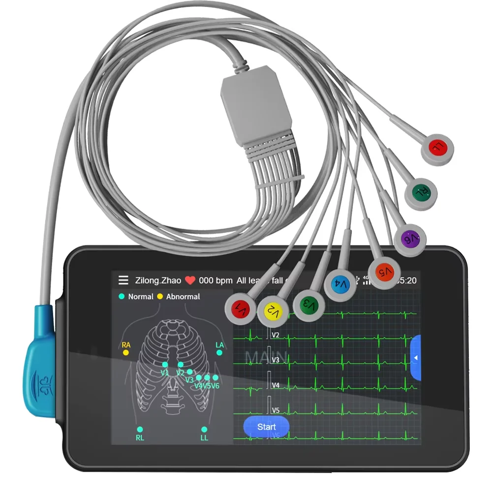 Charge 12-Lead ECG Machine 24-hour Handheld ECG Machine Glasgow Data Analysis Report Adults & Pediatrics Cardiologists