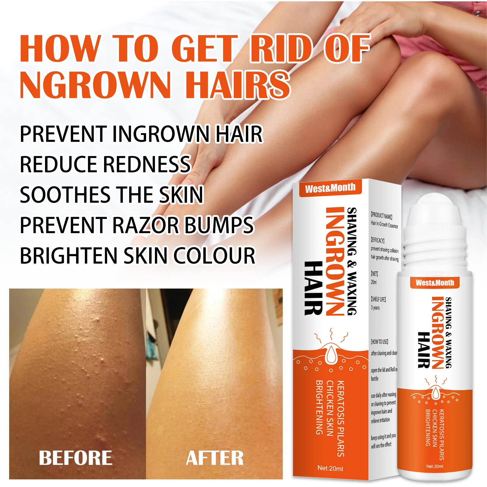 Ingrown Hairs Treatment After Shave Repair Serum Solution Dark Spot Reduce Redness for Vanish Pfb Skin Care Prevent Razor Bumps hair removal skin care
