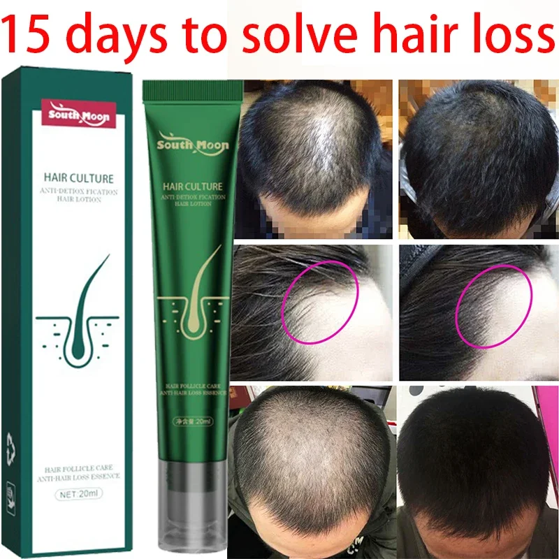 

Anti loss hair care liquid, strong and tough, preventing hair breakage and root damage, ginger hair care, repair and care