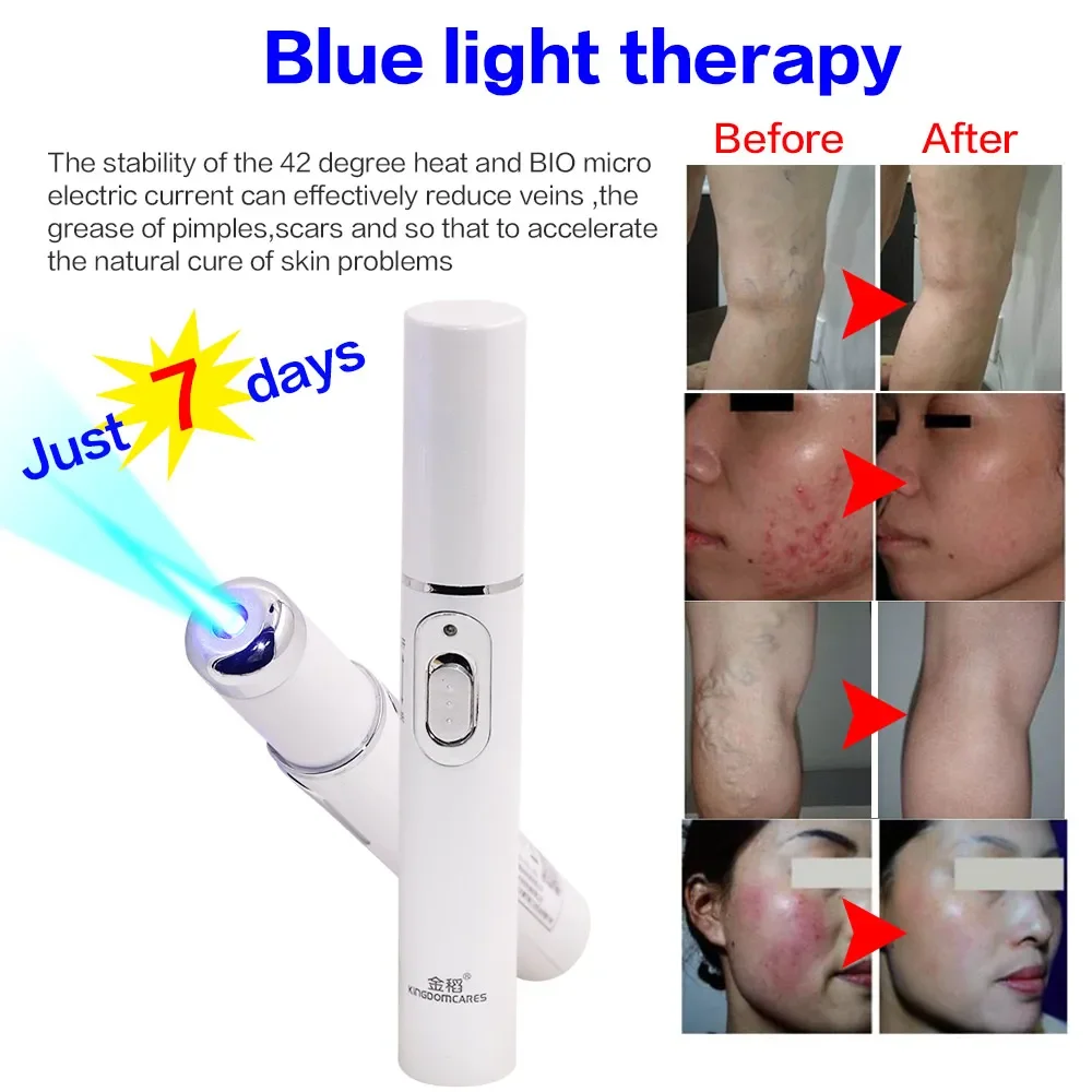 Acne Laser Pen Against Face Remove Varicose Veins Black Dots Blue Light Skincare Anti-Wrinkle Skin Care Beauty Appliances Plasma laser skin treatment
