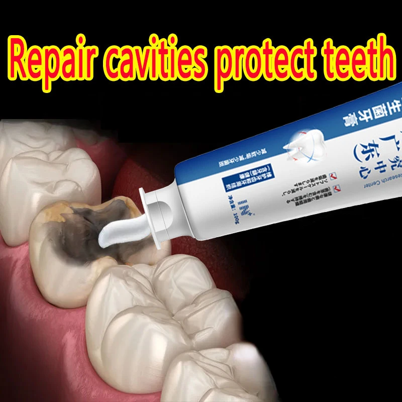 

Quick Repair of Cavities Whitening Toothpaste Removal of Plaque Stains Decay Yellowing Fresh Breath Teeth Cleansing Teeth Care