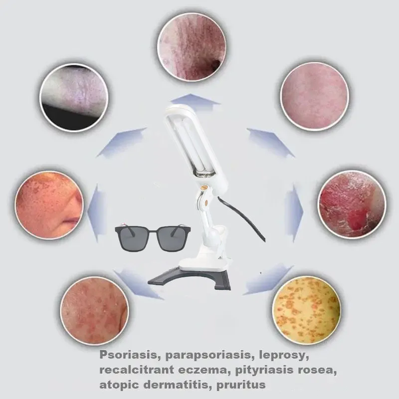 308NM UVB Phototherapy Lamp For Vitiligo Therapy Lamp Skin Diseases Treatment Device Uv Narrow Band Therapy Psoriasis Instrument 5