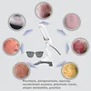 308NM UVB Phototherapy Lamp For Vitiligo Therapy Lamp Skin Diseases Treatment Device Uv Narrow Band Therapy Psoriasis Instrument 5