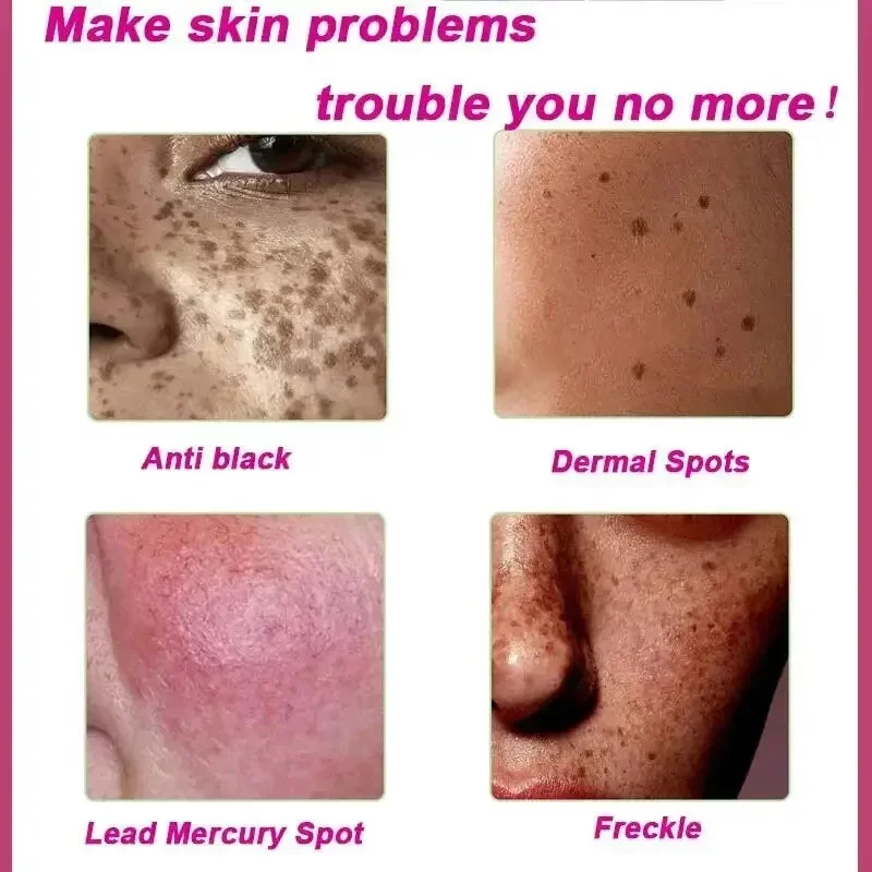 Dark Spots Remover Whitening Facial Serum Face Freckle Melanin Correcting Anti Pigmentation Brighten Skin Care