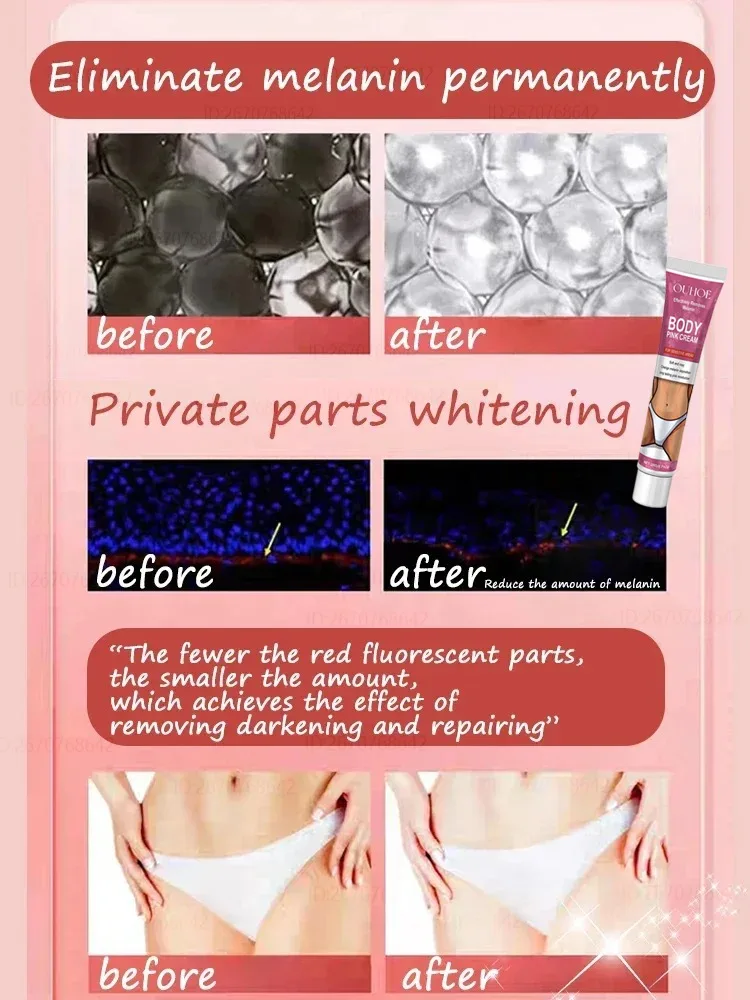 Inner Thigh Bleaching Cream Women