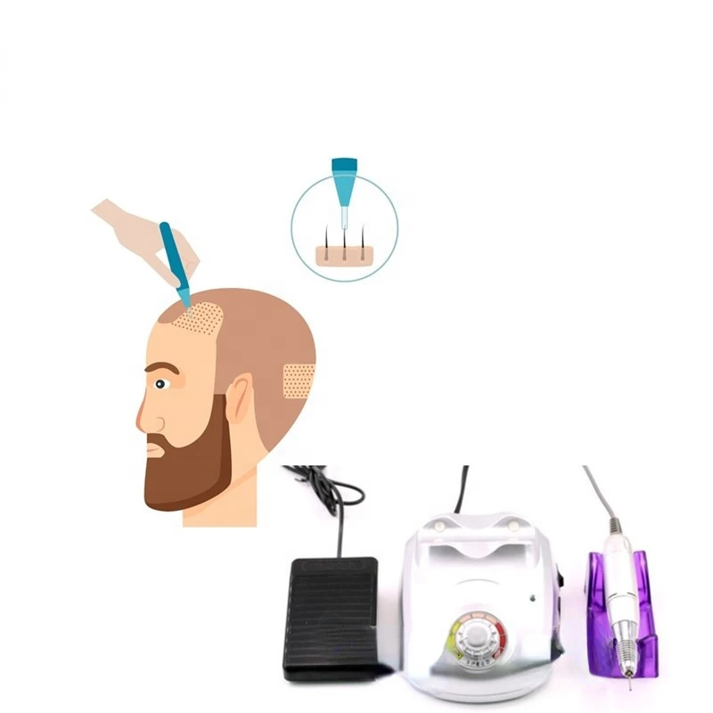 

Fue hair transplant machine fue instruments equipo de trasplante de cabello