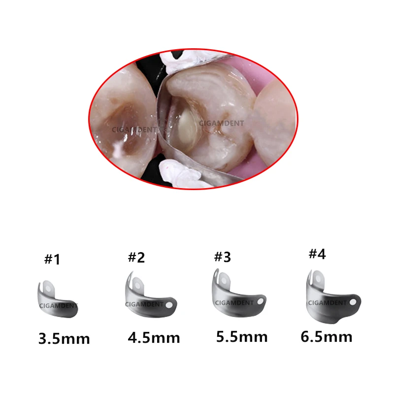 Bande Universali Per Otturazioni Bande Matrice Dentali Sezionali, Anello E Morsetto Per Sistema Palodent V3 - Per Odontoiatria Materiale Odontotecnico - Foto 9