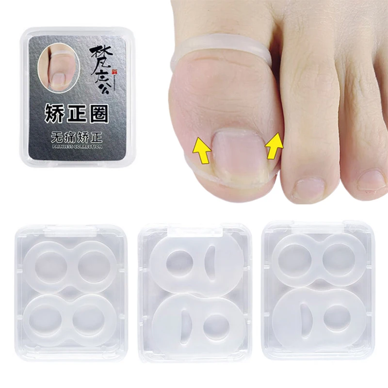 

6 шт., силиконовые повязки для коррекции вросших ног