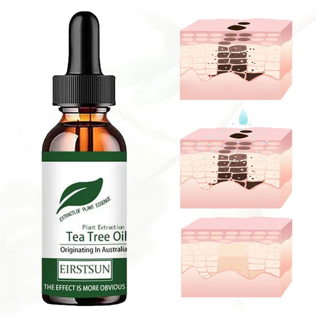 Pure Tea Tree Oil Moisturizer