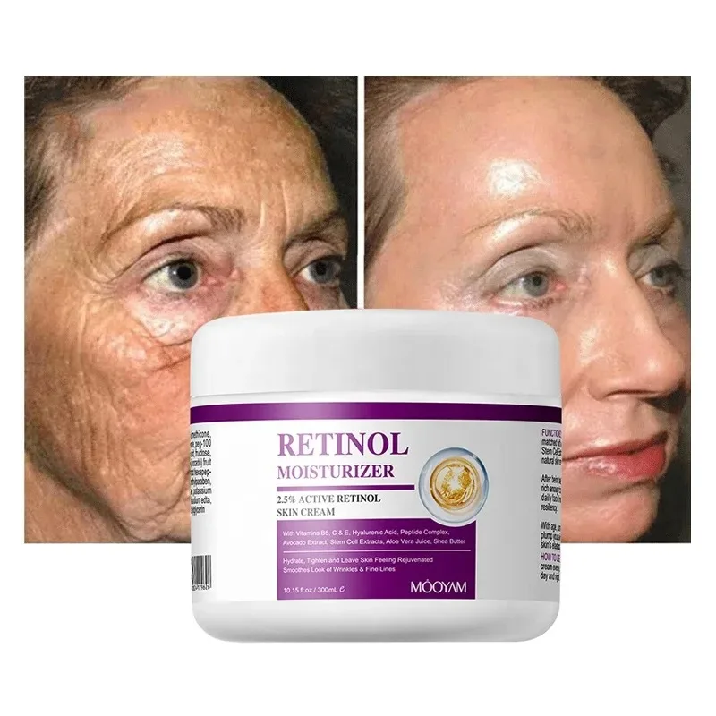300ml Natural Organic Hyaluronic Acid Vitamin C Moisturizer Bleaching Whitening Anti Aging Wrinkles Retinol Face Cream