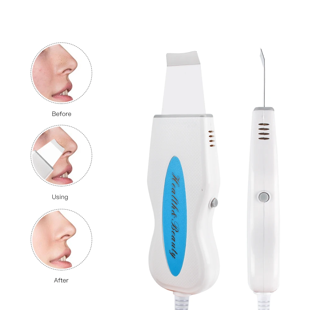 Facial Scrubber Ultrasonic Facial Skin Scrubber Deep Cleaning Blackhead Acne Spots Remover Peeling Beauty