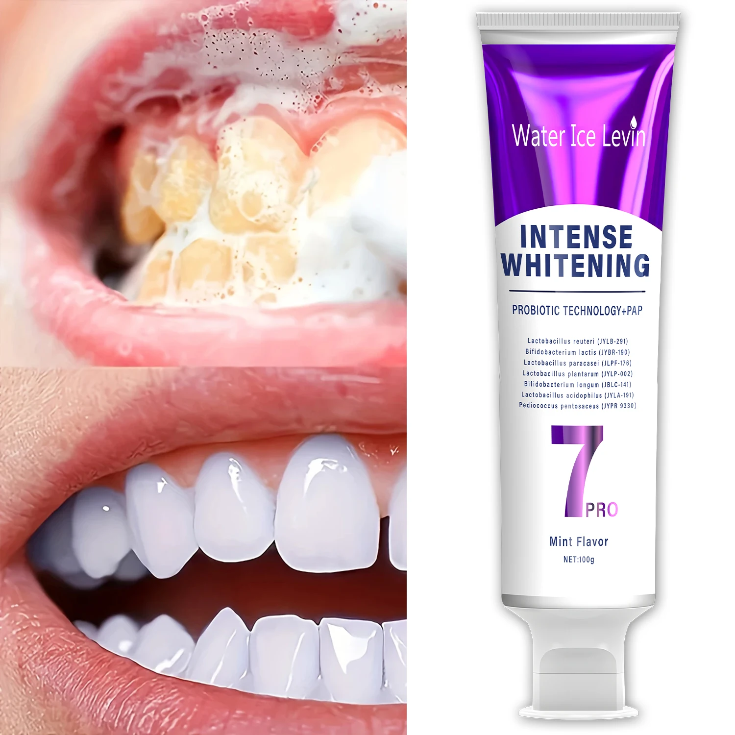 Whitening Probiotic Toothpaste - Fresh Breath & Gum Health