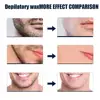 Women Men Hair Removal Wax Paper Nonwoven High Quality Body Leg Arm Hair Removal Epilator Wax Strip Paper Roll 5