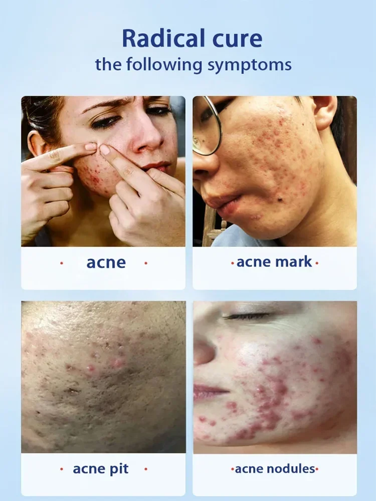 Salicylic Acid  Solution Essence Shrink pores and Acne Spot Removing Shrink Pores Oil-Control Brighten Face Skin Makeup 5
