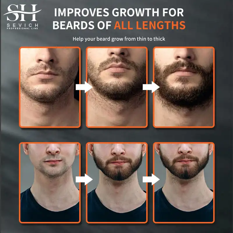 Natural Chebe Men Beard Growth Oil Fast Effective Beard Growth Essential Hair Loss Treatment Product Sevich Beard Care Serum 5