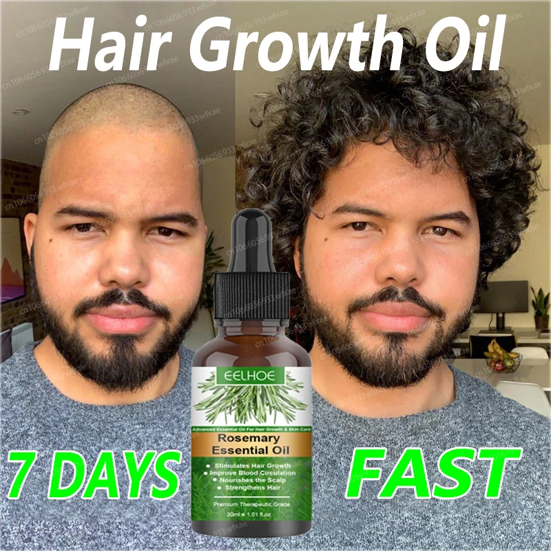 

Rosemary Essential Oil for Hair Growth Reduce Hair Loss Deeply Nourishing Scalp Improves Blood Circulation Hair Growth Oil