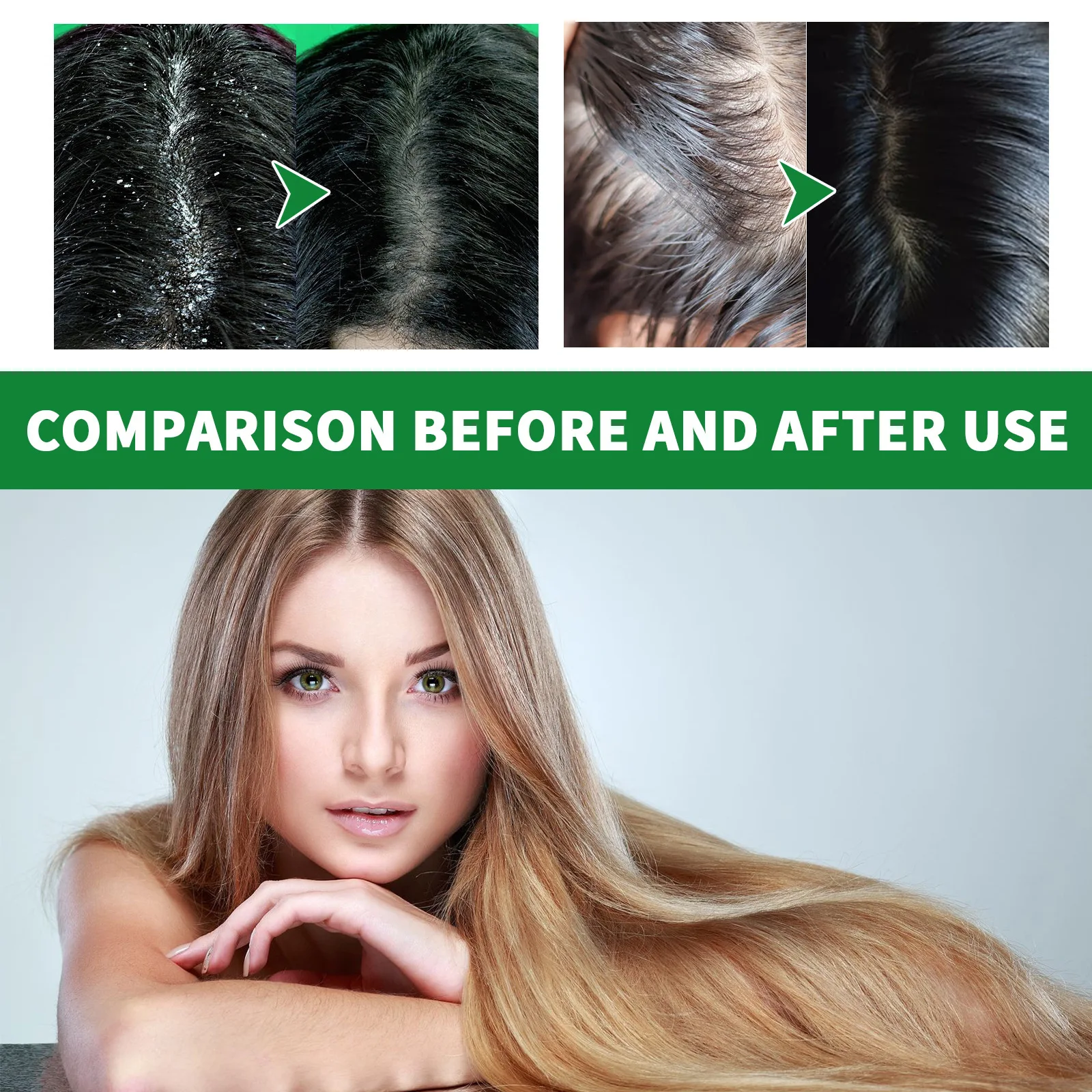 Anti Dandruff Shampoo Seborrheic Anti-Itching Treatment Oil Control Scalp Cleansing Strengthen Hair Roots Smoothing Hair Shampoo hair shampoo