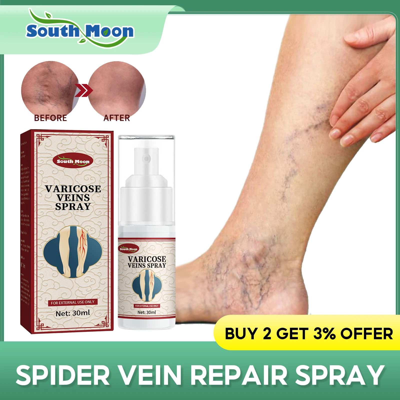 Varicose Veins Treatment Spray Varicocele Dilated Vasculitis Remove