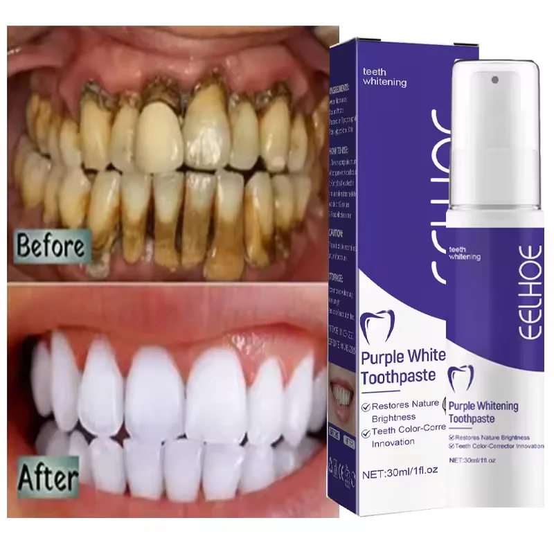 Teeth Whitening Essence Teeth Whitening Product Teeth Health Product Teeth Whitening Toothpaste Serum Remove Plaque Stains Oral Hygiene Cleaning Dental Bleaching Tools Fresh Breath Tooth Care