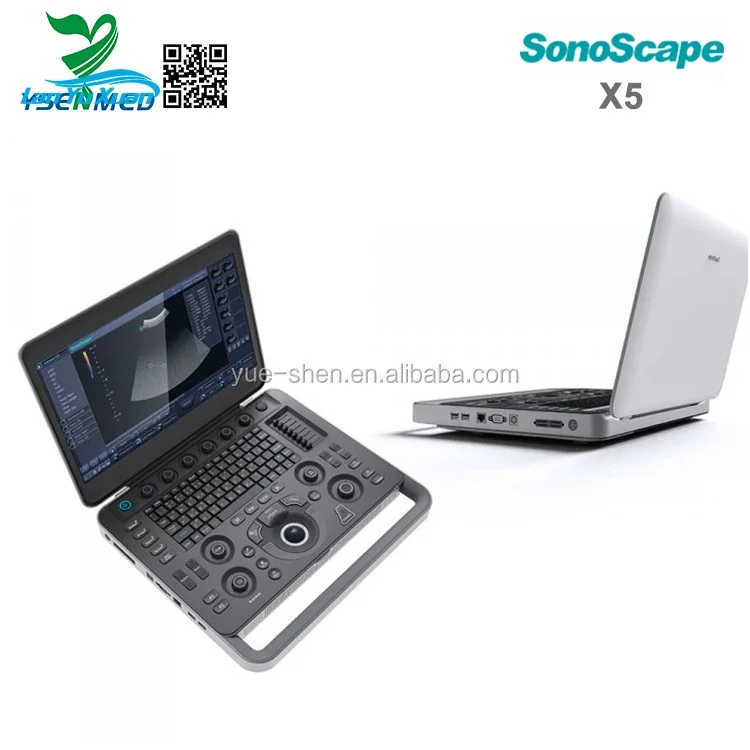 Рисунок 6 - Заводская цена, портативная 3D