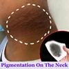 Whitening Cream Private Parts Underarm Bleaching Serum Whiten Butt Knee Brighten Inner Thigh Intimate Parts Dark Remove Melanin 5