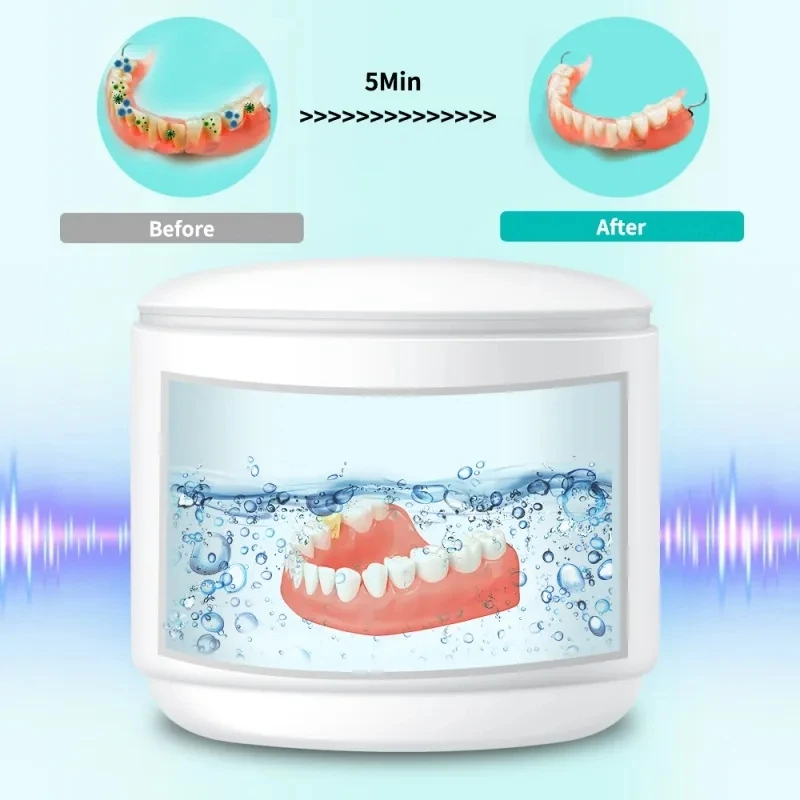 MI Eraclean Ultrasonic Cleaner For Invisible Braces Mini Portable Cleaning Machine With Storage Bag Rechargeable Denture Cleaner 3