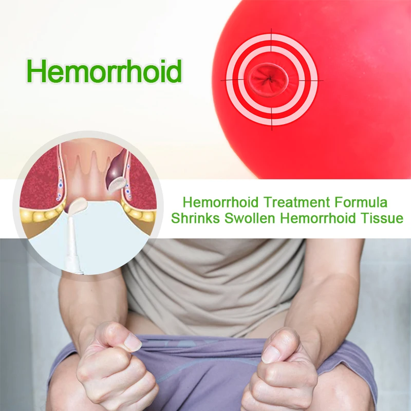 1/3/5/10Pcs Sumifun Huatuo Hemorrhoid Ointment Anal Fissure Bleeding Pain Relief External Internal Hemorrhoids Health Care Cream