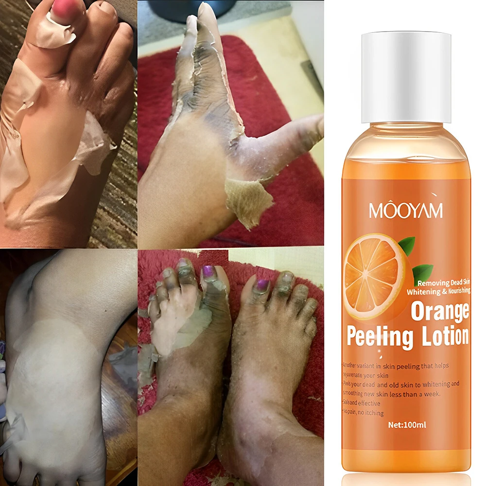 1pcs Foot Peeling lotion Natural Orange Essence Pedicure Hands Dead Skin Exfoliator Mask Whiten Baby Whitening Peeling Lotion