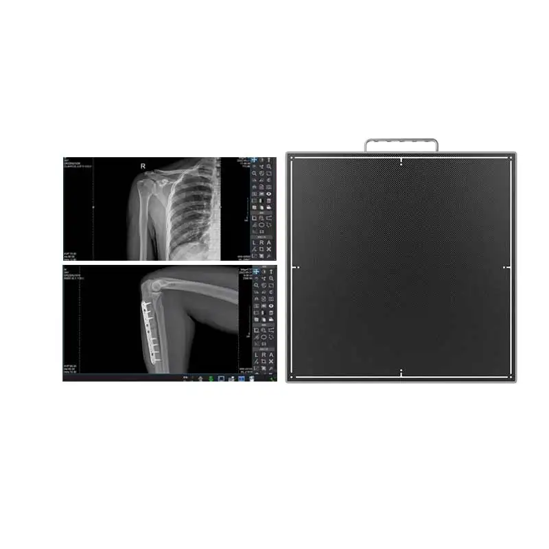 Беспроводная рентгеновская панель CareRay