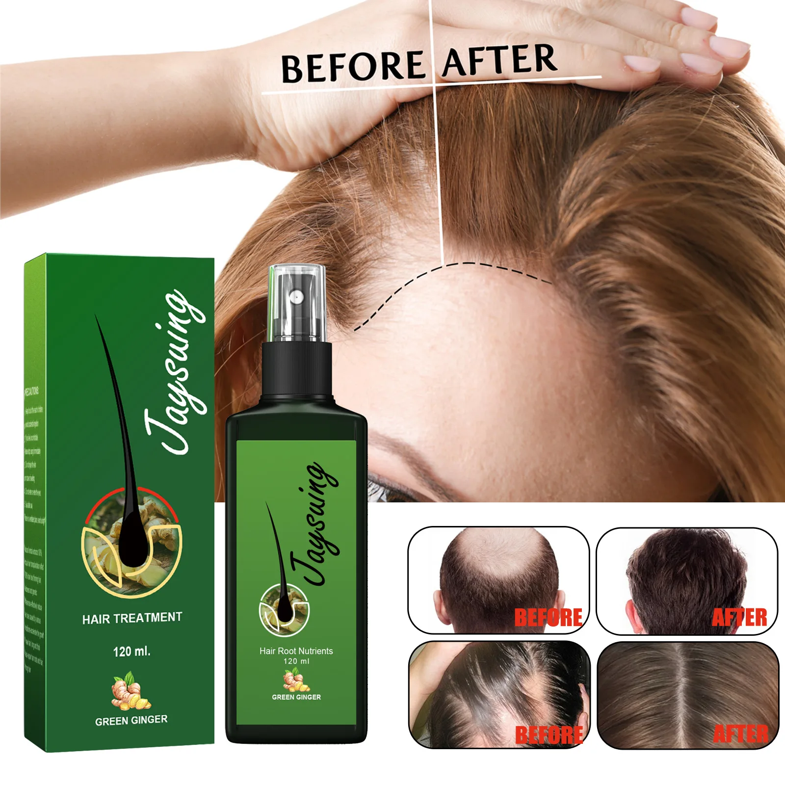 Jaysuing Hair Growth Oil Strong Hair Scalp Massage Liquid Fast Growing Germinal Anti-loss Treatment Serum Care