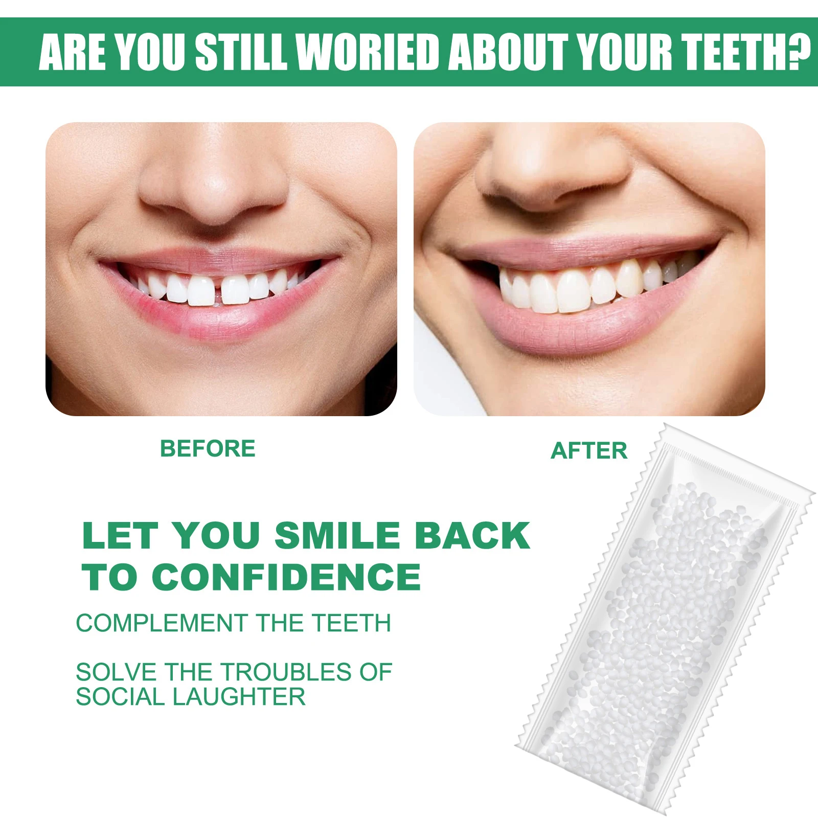 

Набор для временного ремонта зубов Sdotter 10 г/15 г/25 г, твердый клей для накладных зубов, инструмент для отбеливания зубов, устройство для наполнения зубов K