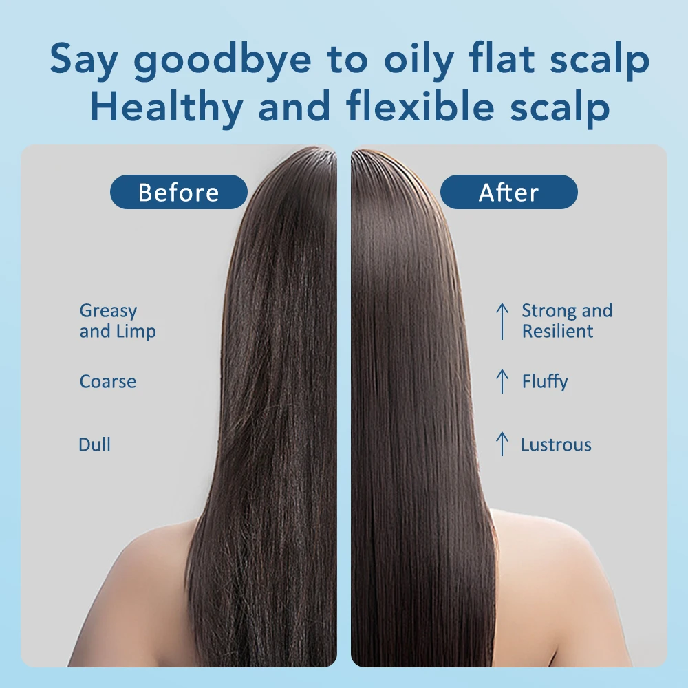 مشط تدليك كهربائي للعلاج بالضوء الأحمر والأزرق مضا...