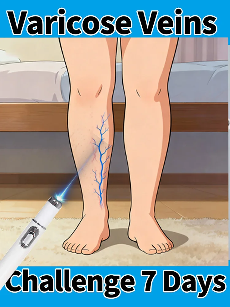 2025 Upgraded Second Generation Tool Blue Light Laser Repair Varicose Veins
