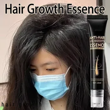 52SF Thick Hair Growth Essence Anti Hair Loss Serum Baldness Repair Hereditary Postpartum Seborrheic Hair Loss Oil Care