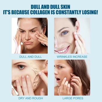 30ml V89 Probiotic Concentrate Anti-Wrinkle Serum Hyaluronic Acid Anti Aging Brightening Cream Facial Lifting Firming Daily - Thumbnail 4