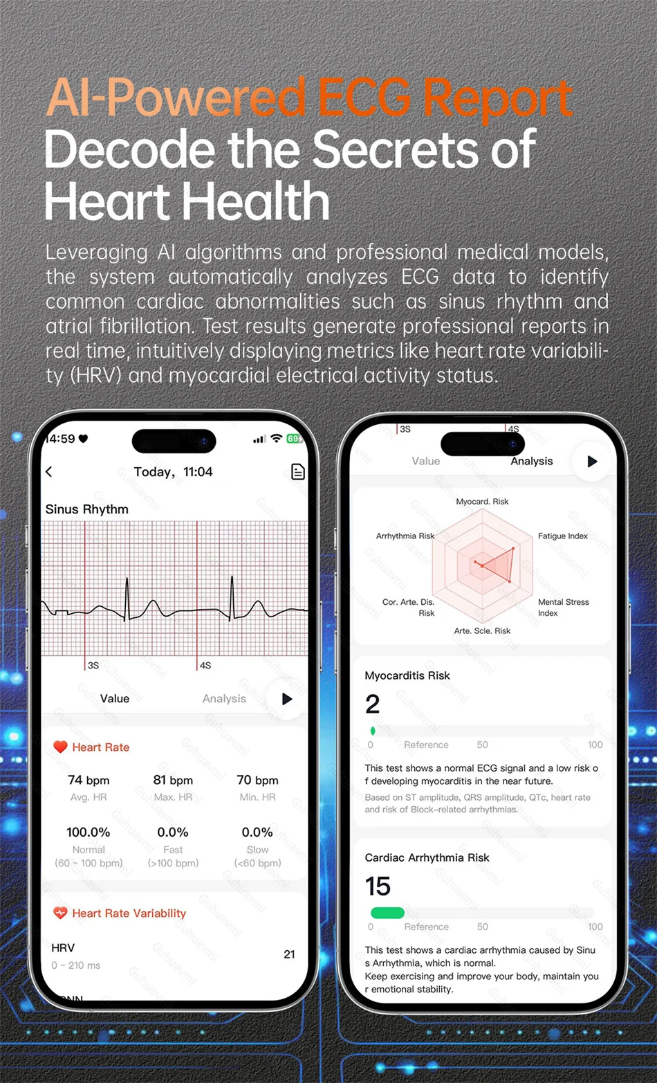 MAVHX 2026 - Sleep Monitor