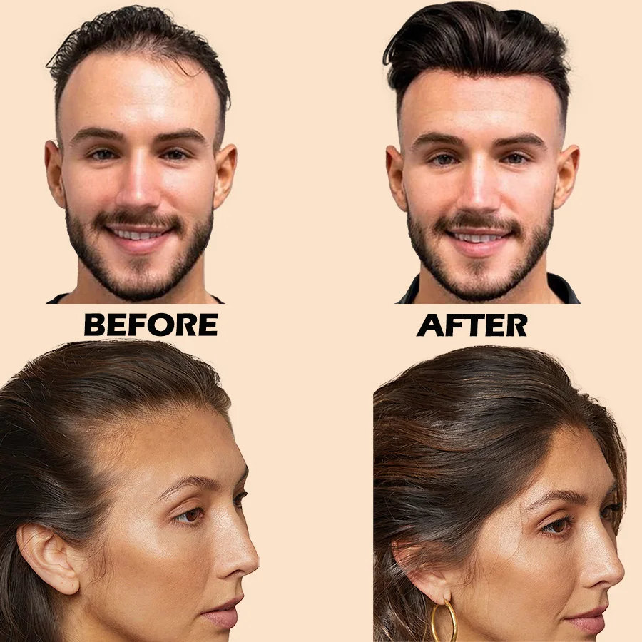Fiber Hold Spray Hair Building Fibers Powder Hair Thickening Spray for Men and Women hair thickening spray