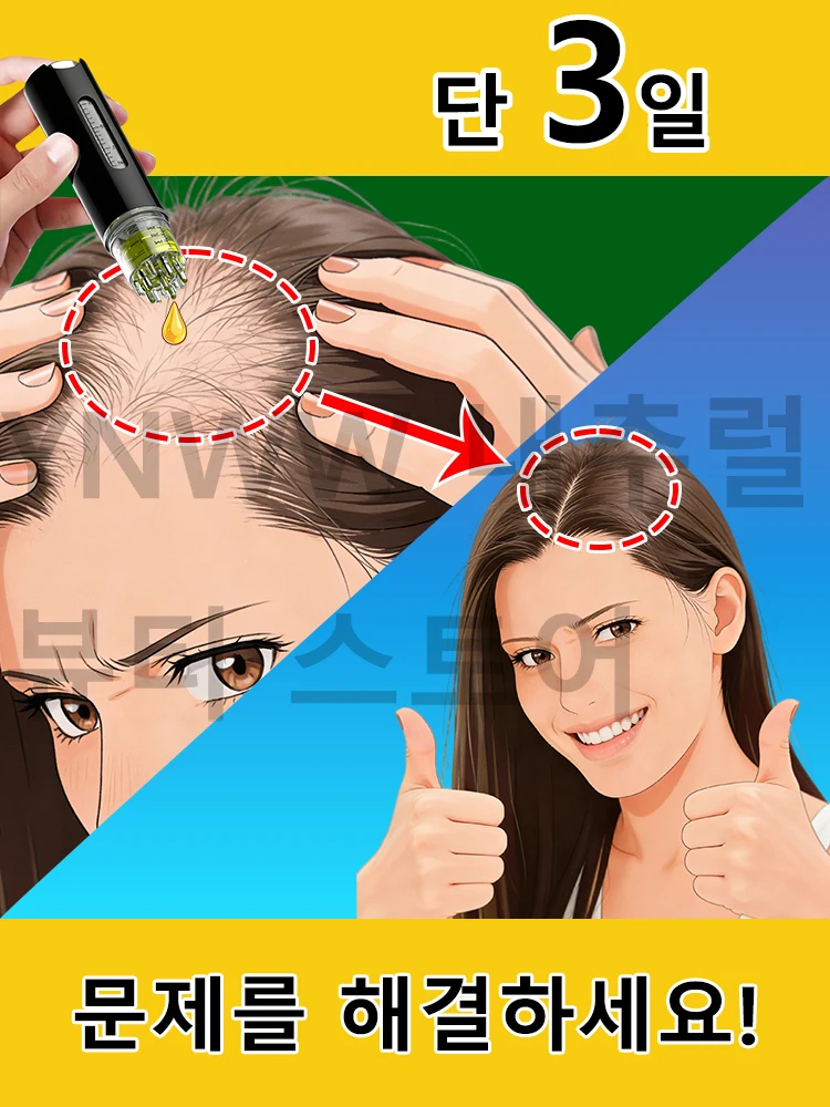 2026년형 새로운 헤드 어플리케이터, 두피 어플리케이터, 헤어 성장 세럼, 두피..