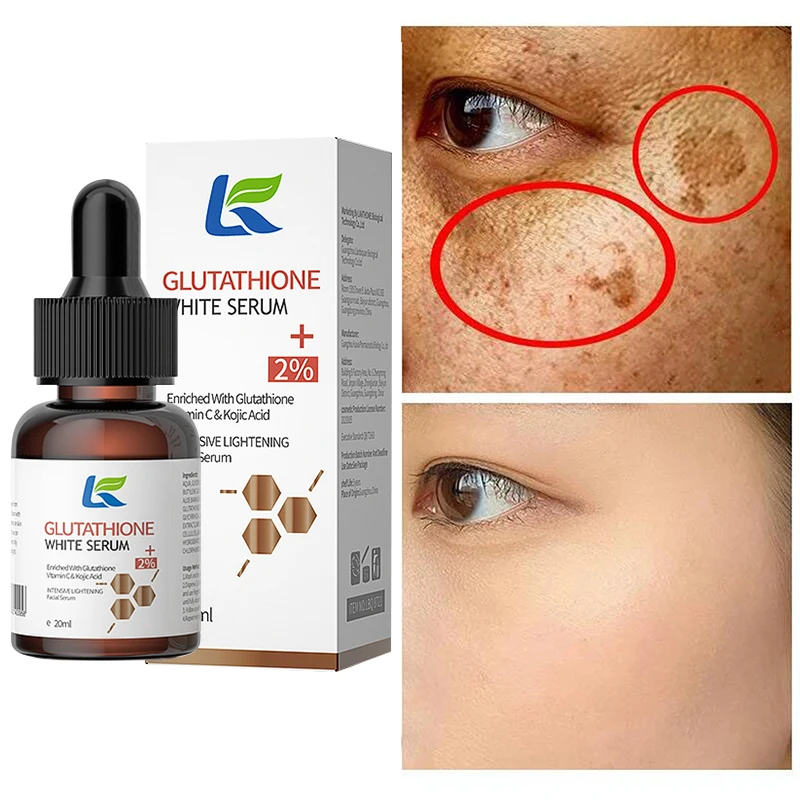 Whitening Serum Fade Dark Spot Freckle Brighten Essence Remove Pigment Melanin Correcting Beauty Face Skin Care