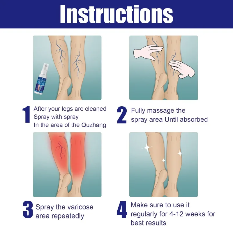 Body Cream 30ml Varicose Vein Spray Vasculitis Phlebitis Relief Cream Spider Legs Treatment Smoothing Blood Vessel Redness Herbal Body Care