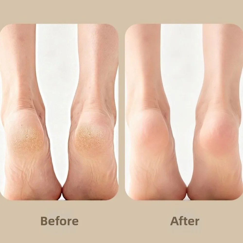 3 in 1 Foot Brush Scrubber Ergonomic With Handle Pedicure Scraper Foot File Handheld Exfoliating Dead Skin Callus Remover