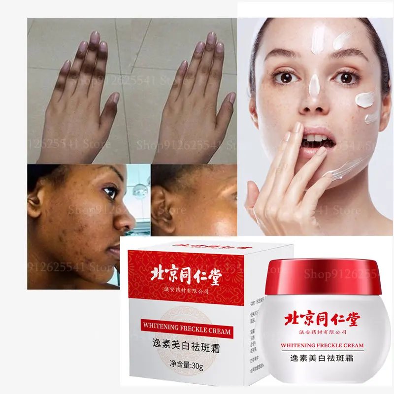 Niacinamide Skin Whitening Day Cream Remove Melasma Acne Spot Pigment Melanin Dark Spots Pigmentation Whitening Cream