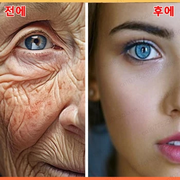 주름 방지 노화 즉각적인 효과 얼굴 주름 제거