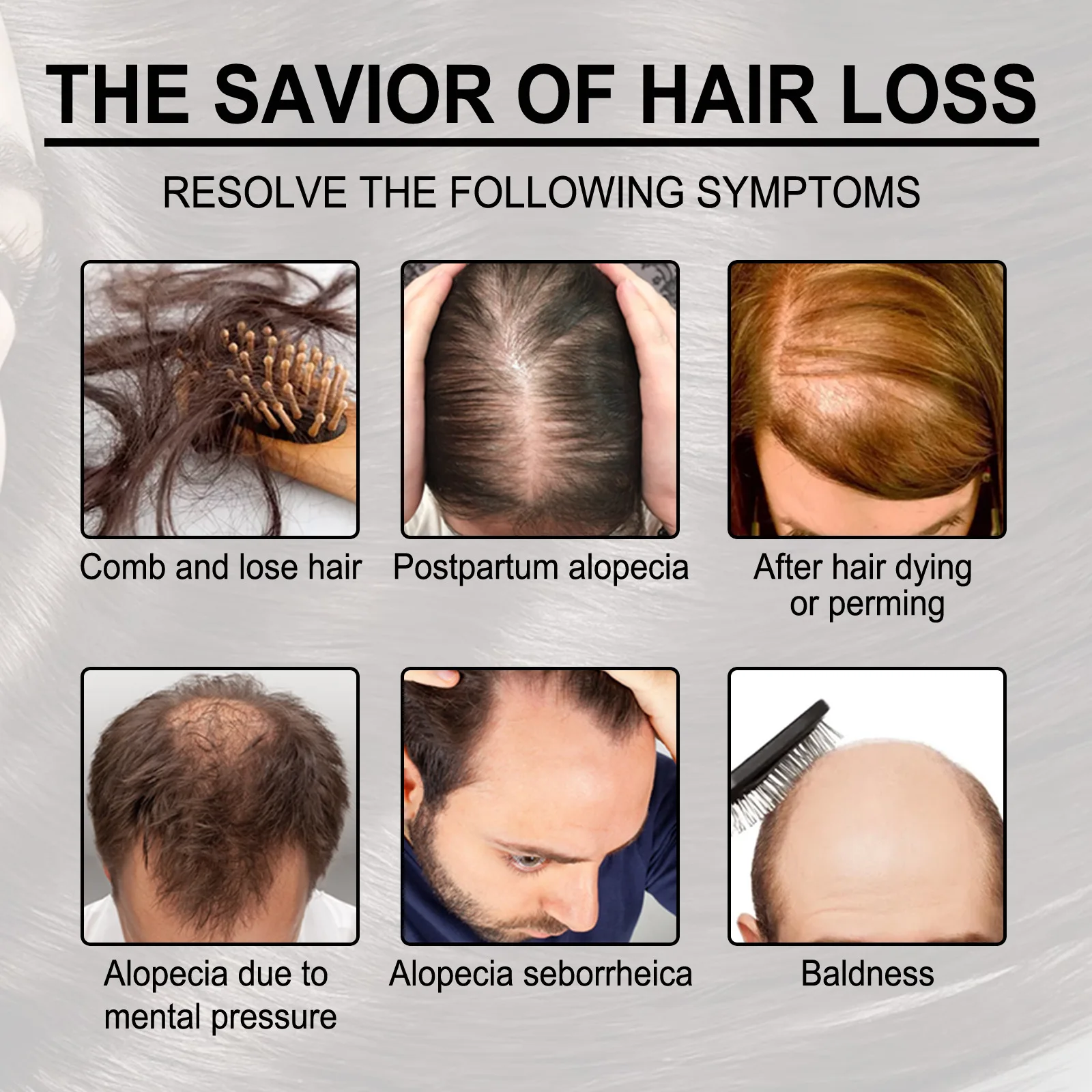 Anti Hair Loss Shampoo Repair Baldness Reduce Dandruff Itching Scalp Treatment Strengthen Thicken Nourishing Hair Growth Shampoo 3