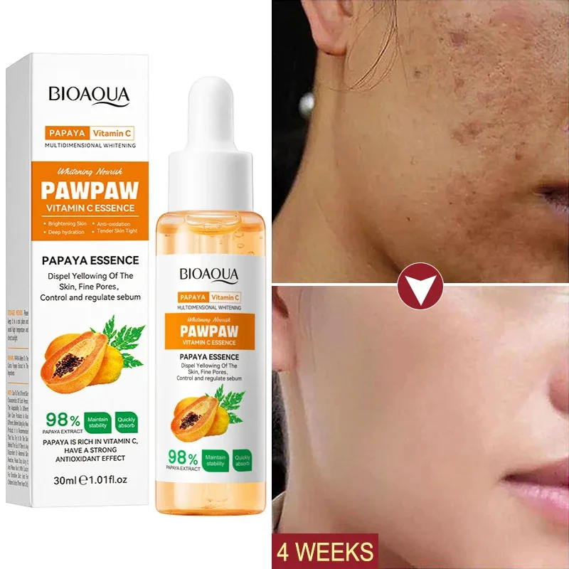 

Whitening Serum Effective Remove Freckle Liquid Fade Melasma Dark Spots Fade Melanin Whiten Brighten Korea Skin Care Products