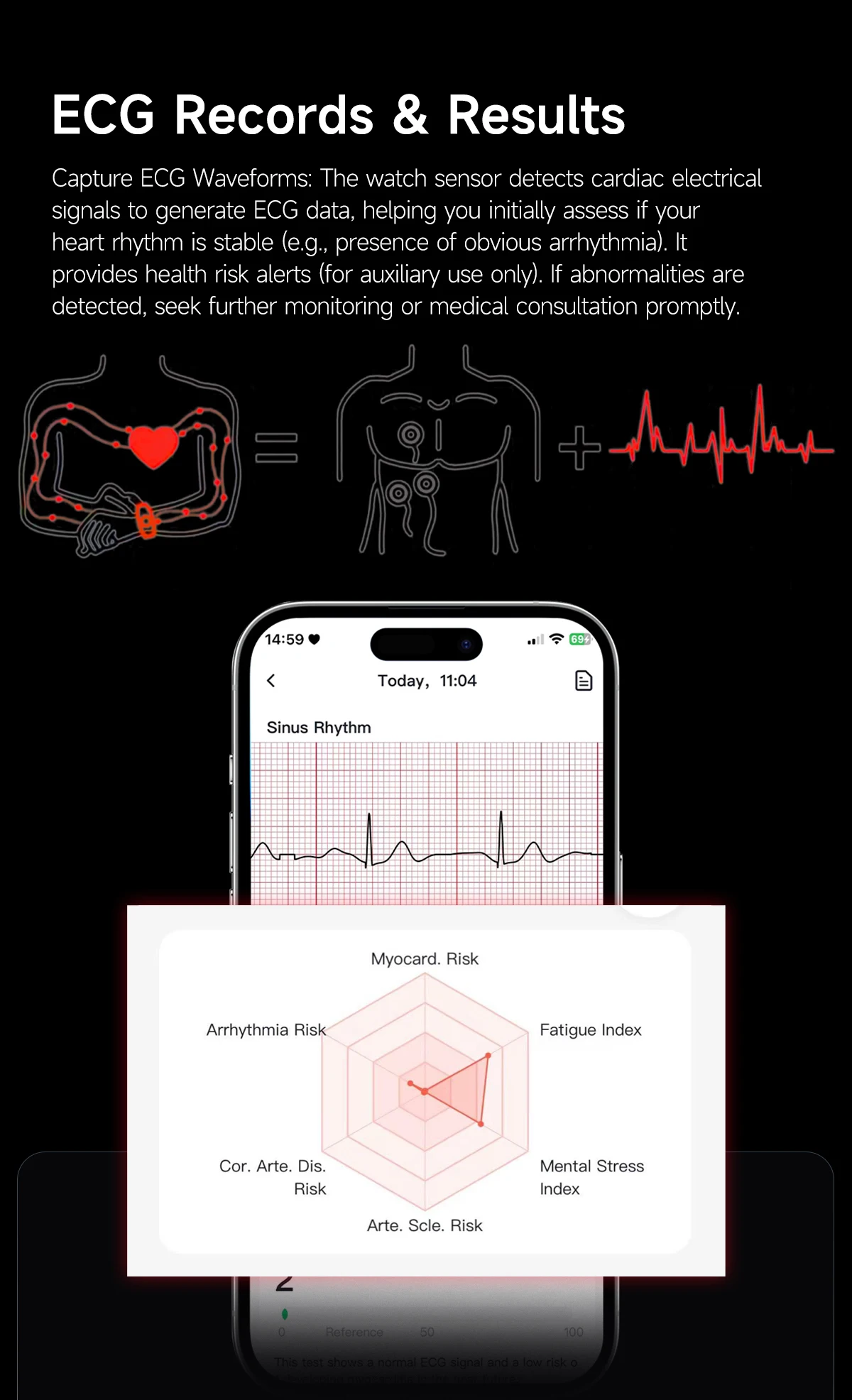 New No Screen Health Bracelet Precise Heart Rate Blood Pressure ECG Monitor Call Reminder Smart Watch Sport Band Fitness Tracker