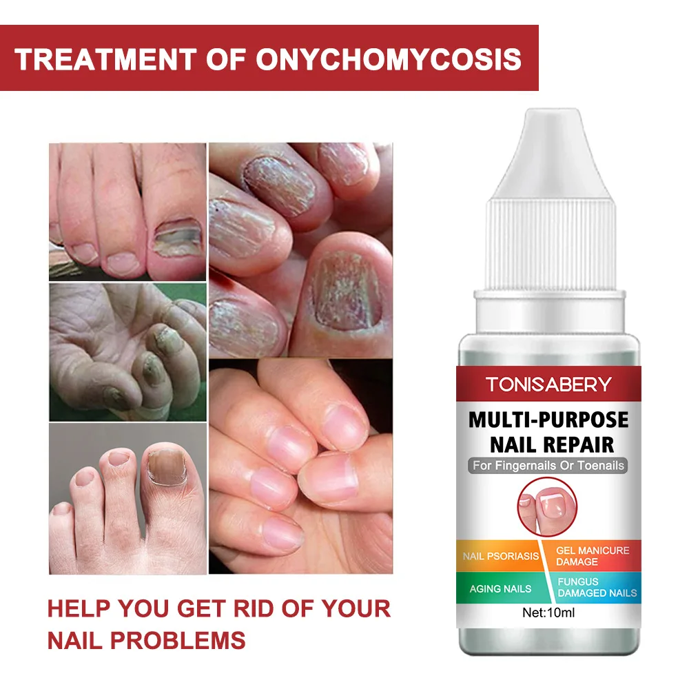 10ml Gray nail Repair Solution Hand and Foot Care Nourishing Repair Solution Moisturizing and Smoothing Nail Polish