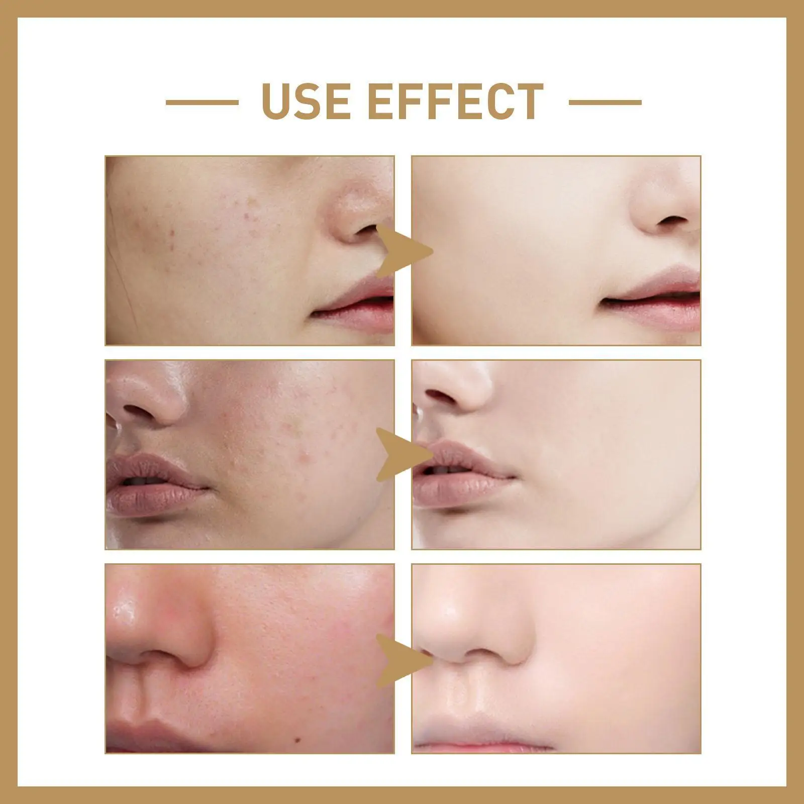 Glycolic Acid 7% Toning Solution 100ml Repairing Facial Oil Nourishing Gentle Glycolic Acid Toner Face Essence facial serum facial essence rice water toner