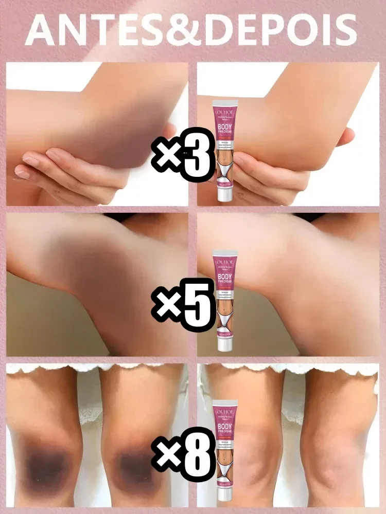 Inner Thigh Bleaching Cream Intimate Area Lightening Emulsion Butt Private Parts Brightening Cream Women Knuckles Bleach Serum 4