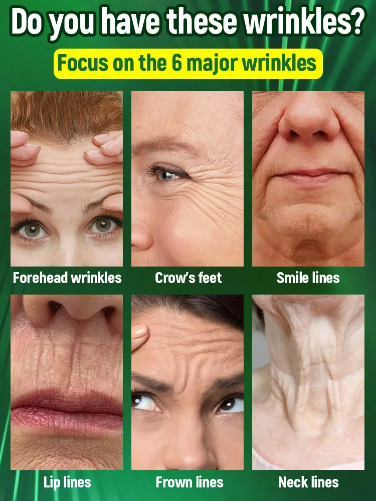Wrinkles disappear, the first choice for women who love beauty 5